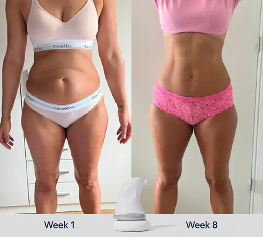 BodySculpt™ - Skin Tightening & Toning Device